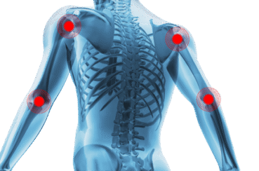 Health with the Hamels : The good, the bad and the ugly of inflammation