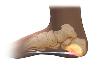 Health with the Hamels : Dealing with plantar fasciitis